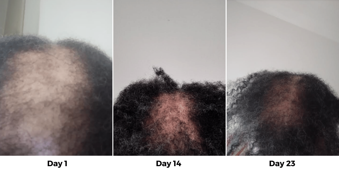 Serum Crecimiento Cabello Afro HairGrowth®