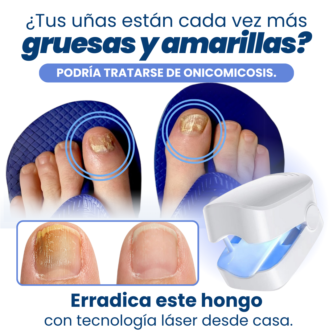 LAMPARA LASER PARA UÑAS