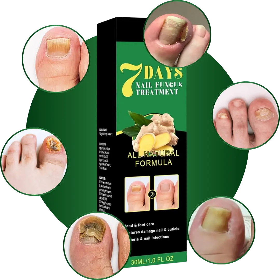 Serum AntiHogos 7 Days®