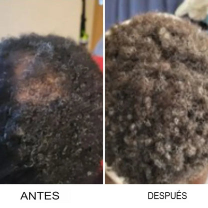 Serum Crecimiento Cabello Afro HairGrowth®