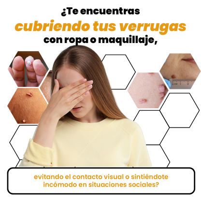 ReliefSpray™ Removedor de Verrugas