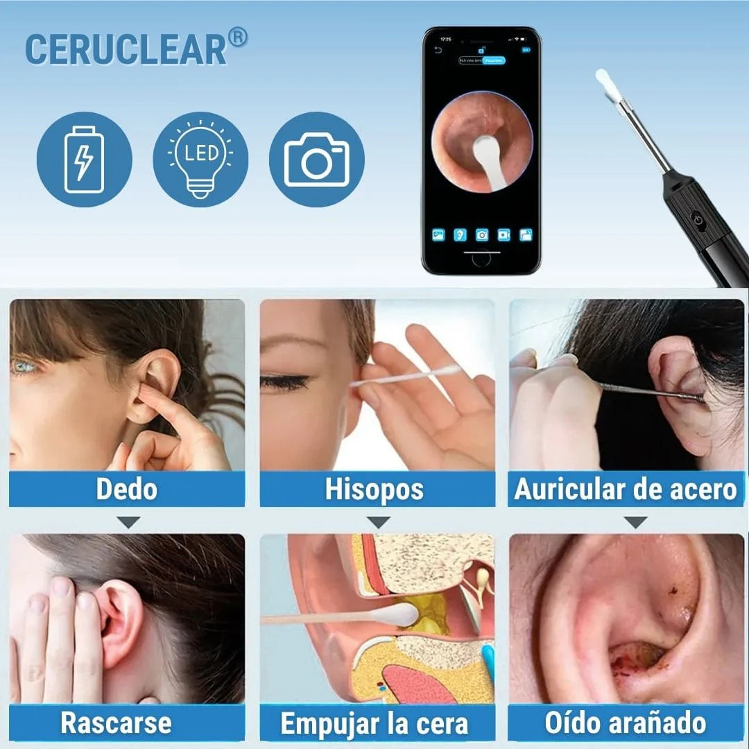 EarClear® Limpiador de Oido con Cámara