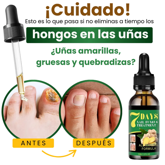 Serum AntiHogos 7 Days®