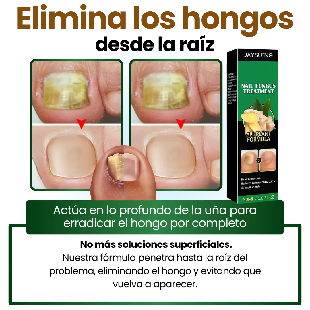 Serum AntiHogos 7 Days®