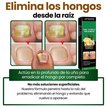 Serum AntiHogos 7 Days®