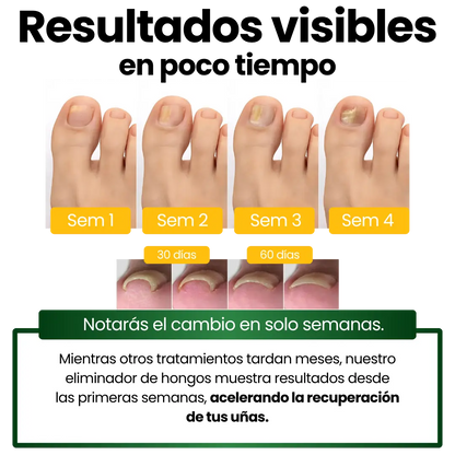 Serum AntiHogos 7 Days®